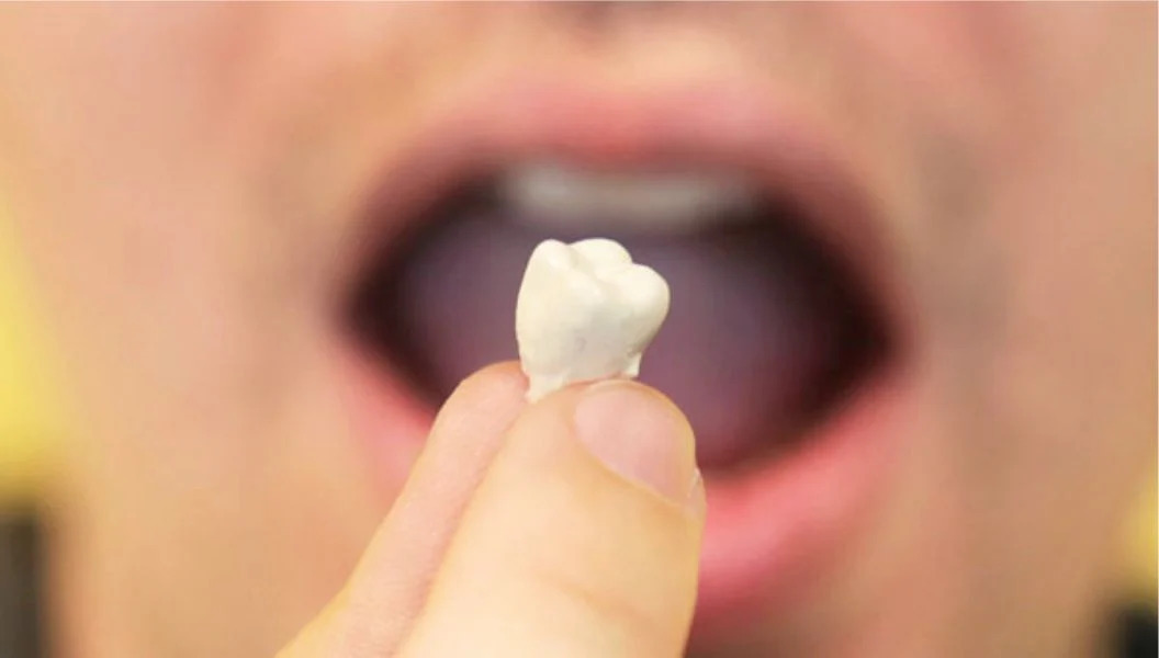 Выпал передний зуб во сне